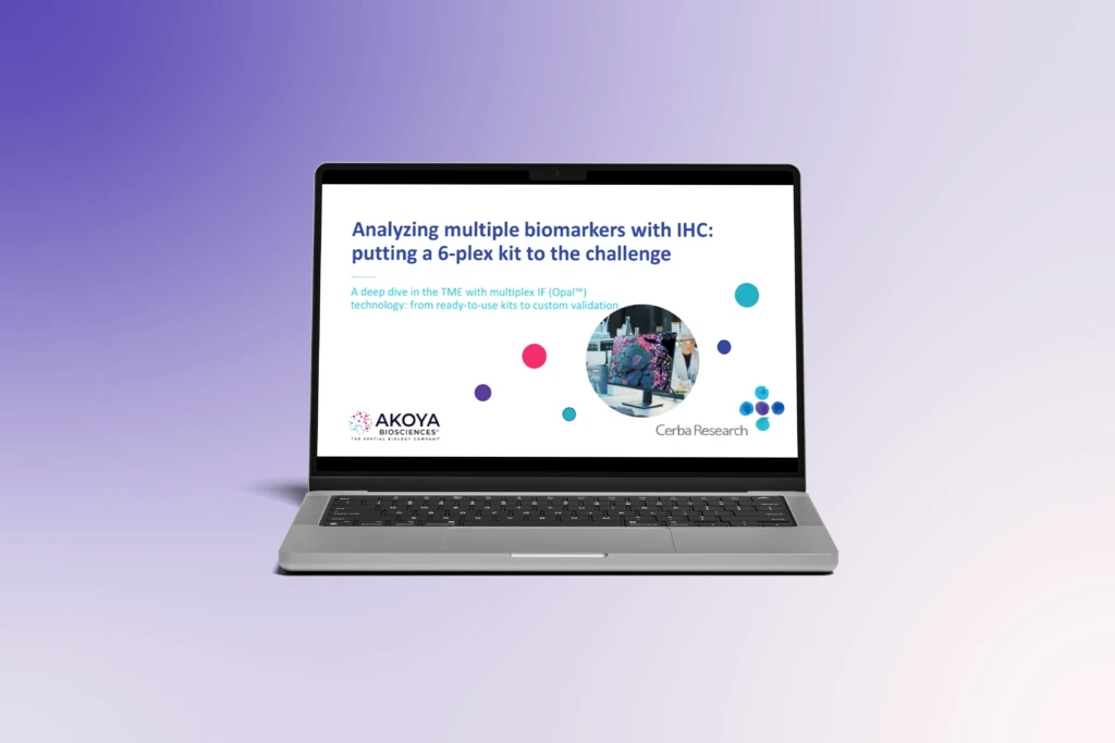 Analyzing Multiple Biomarkers with IHC- Putting a 6‑Plex Kit to the Challenge