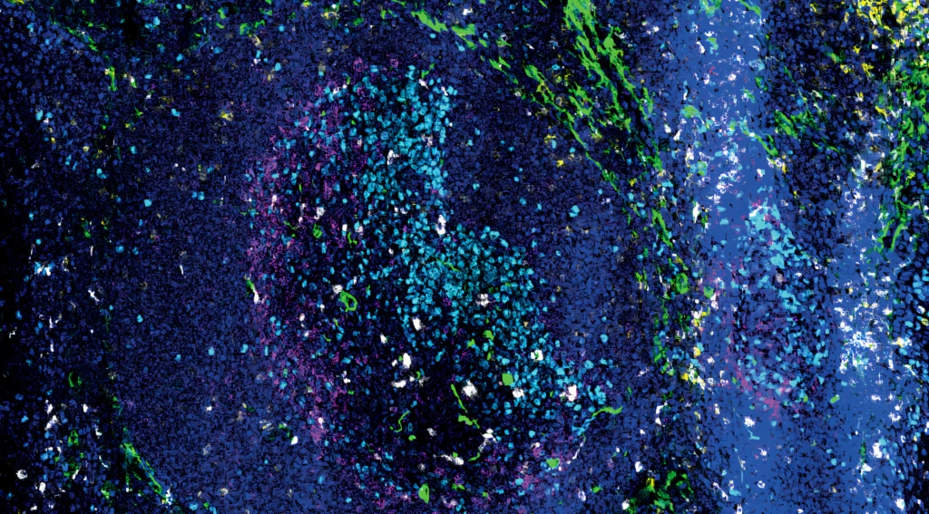 Representative image of 5 targets in a 12plex. CD68 (Clone KP1, White), CD8 (Clone RPA-T8, Yellow), PD1 (Clone EH12.2H7, Magenta), KI67 (Clone B56, Cyan), Collagen (Polyclonal, Lime green) multiplex IMC staining of Frozen Tonsil sample.