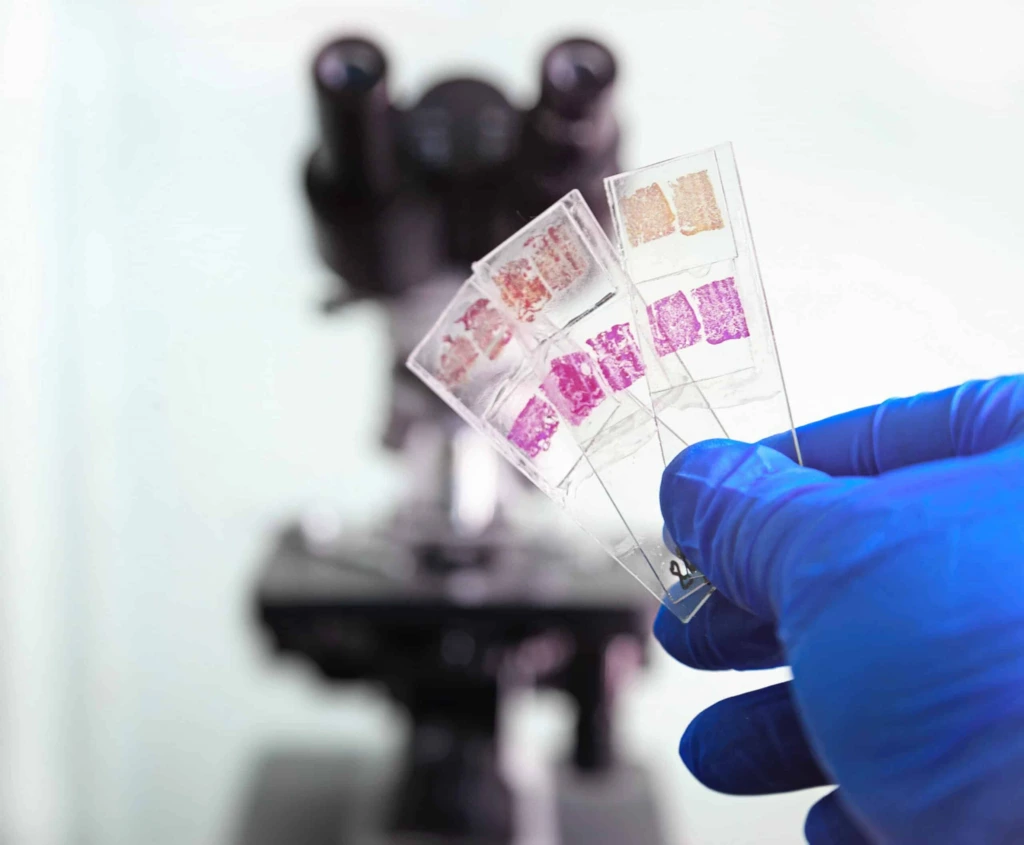 Glass,Slides,In,The,Laboratory.,Hand,In,Blue,Glove,Holding