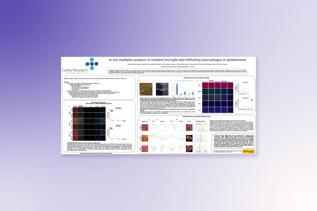 In Situ Multiplex Analysis of Microglia and Macrophages in Glioblastoma