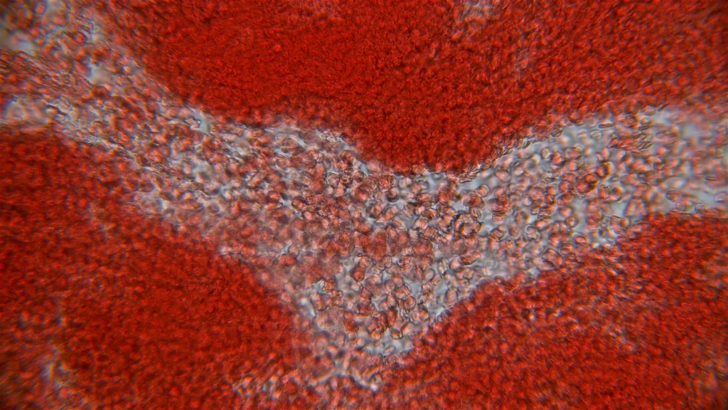 Human,Blood,Under,A,Microscope.,You,Can,See,Erythrocytes,