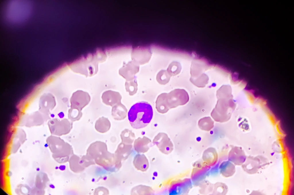 Neutrophils,Is,A,Kinds,Of,Wbc,Or,White,Blood,Cells