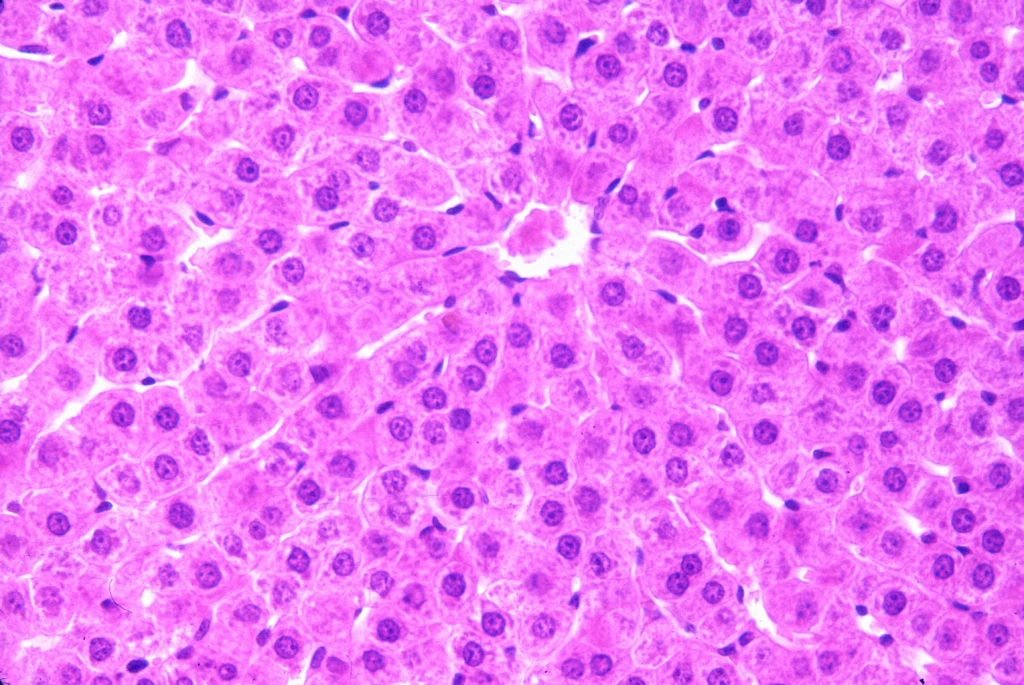 Human,Liver,Showing,A,Liver,Lobule.,The,Central,Vein,Is