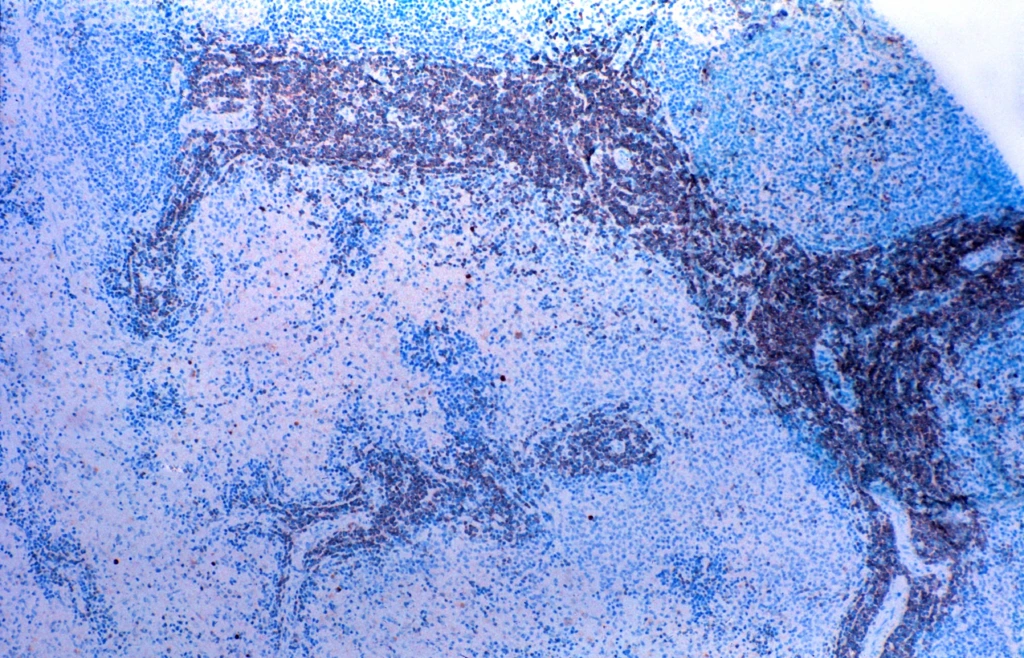 Light,Microscope,Micrograph,Of,A,Human,Spleen,Immunostained,For,T