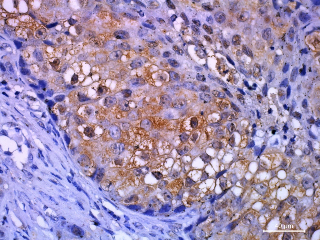 Immunohistochemistry,Staining,Is,Used,In,Histopathology,To,Do,Research,Or
